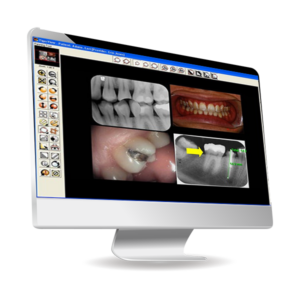 QuickView Dental Imaging Software