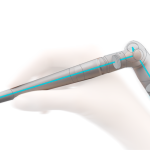 LiteTouch Er:YAG Laser-in-Handpiece